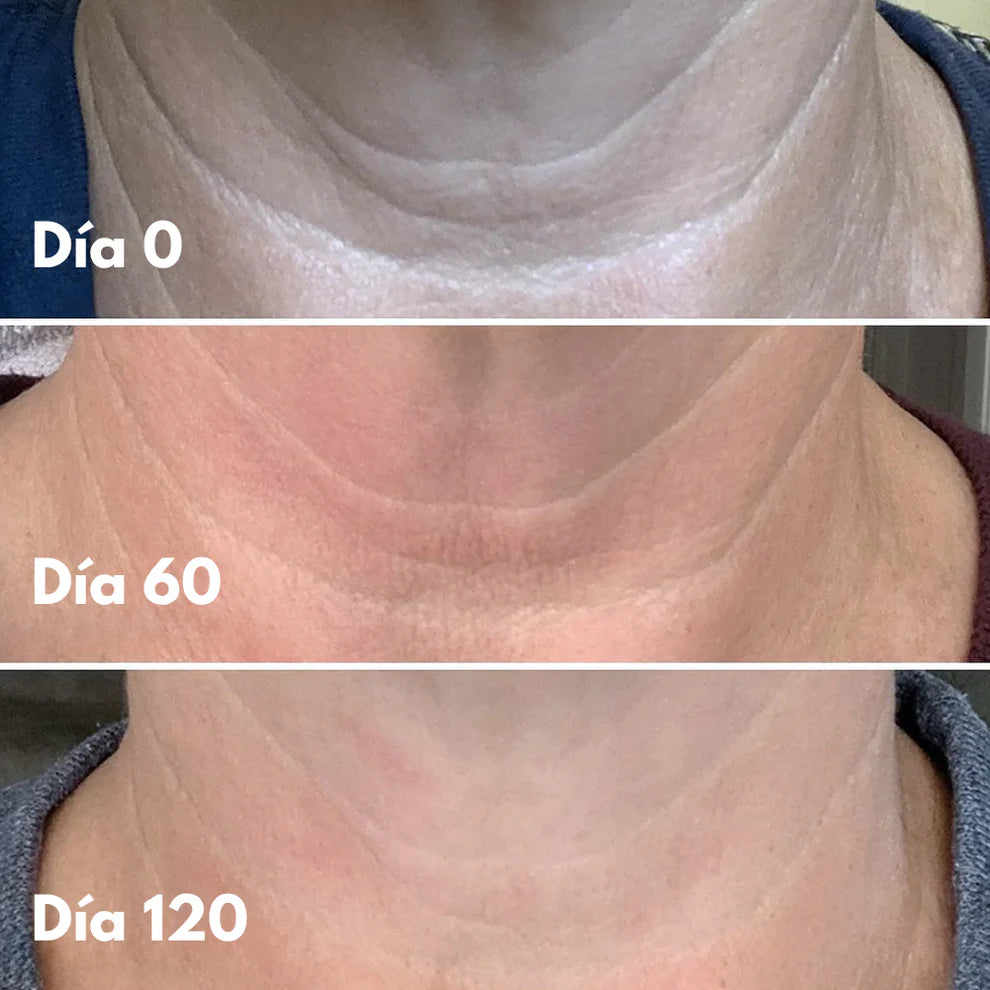 2x1 Crema reafirmante 4 en 1 - Cuello y papada reafirmado este Verano (2 meses)