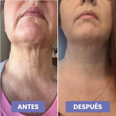2x1 Crema reafirmante 4 en 1 - Cuello y papada reafirmado este Verano (2 meses)