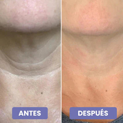 2x1 Crema reafirmante 4 en 1 - Cuello y papada reafirmado este Verano (2 meses)