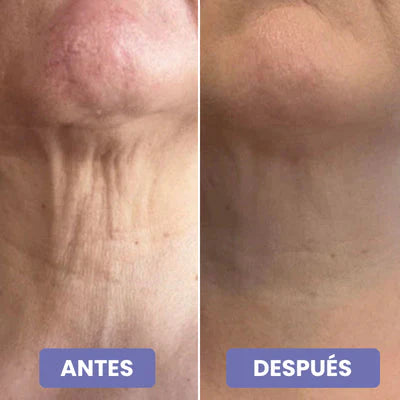 2x1 Crema reafirmante 4 en 1 - Cuello y papada reafirmado este Verano (2 meses)