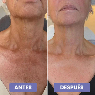 2x1 Crema reafirmante 4 en 1 - Cuello y papada reafirmado este Verano (2 meses)